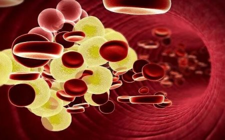 Managing High Cholesterolemia in Dubai: Lifestyle Changes and Medical Treatments