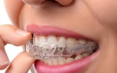 Invisalign in Dubai: The Modern Solution to Straighten Teeth