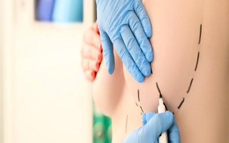 Elevate Your Self-Esteem: Exploring Breast Augmentation in Riyadh