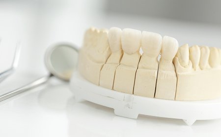 Restore Your Smile: Best Ways to Replace Missing Teeth in Sun City