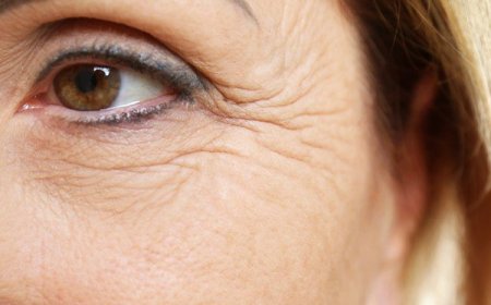 How to Maintain Results After Wrinkles Treatment Near You