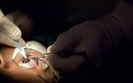 Financing Options for LASIK Eye Surgery in Adelaide