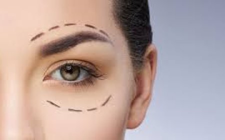 Upper Blepharoplasty in Jeddah: Lift Droopy Eyelids and Refresh Your Look