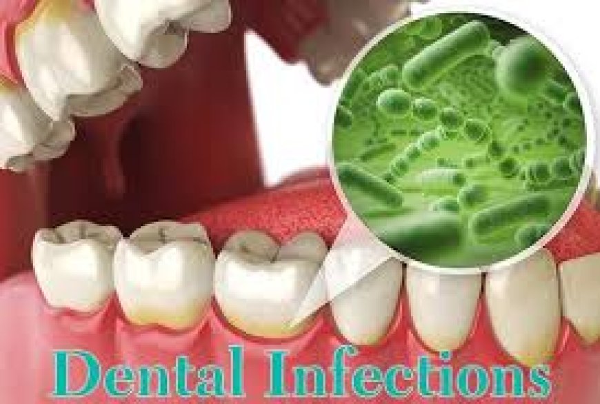 Managing Tooth Infection Pain with Aspadol 75 mg