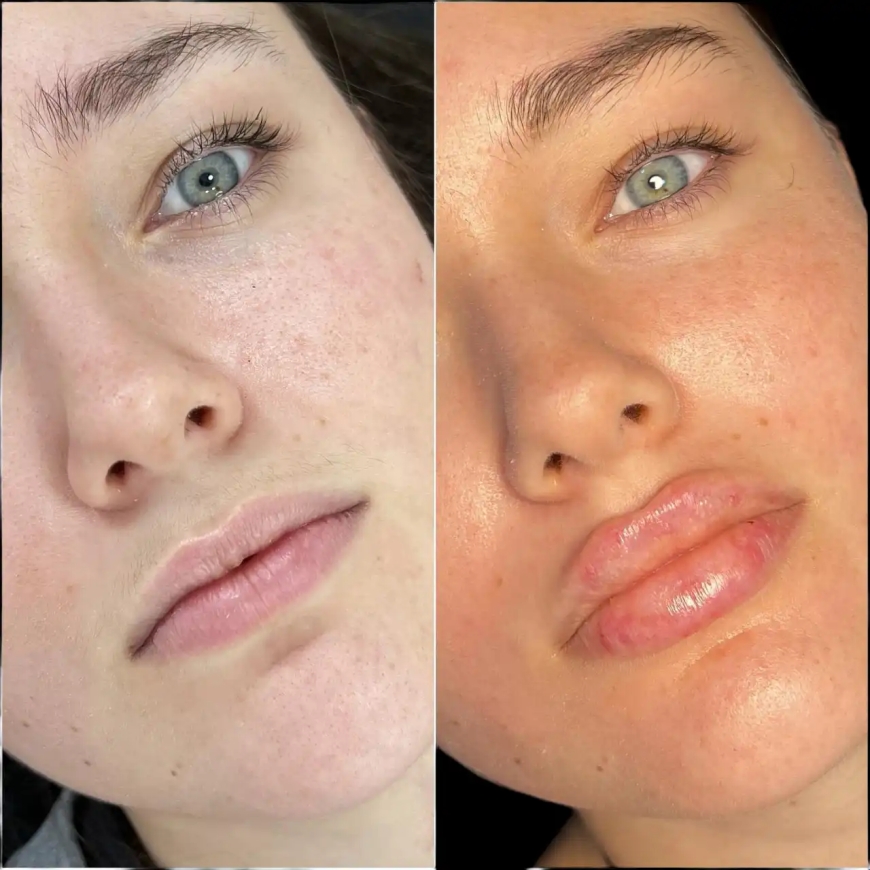 Best Plastic Surgeon in Dubai for Fillers: Age Gracefully and Confidently