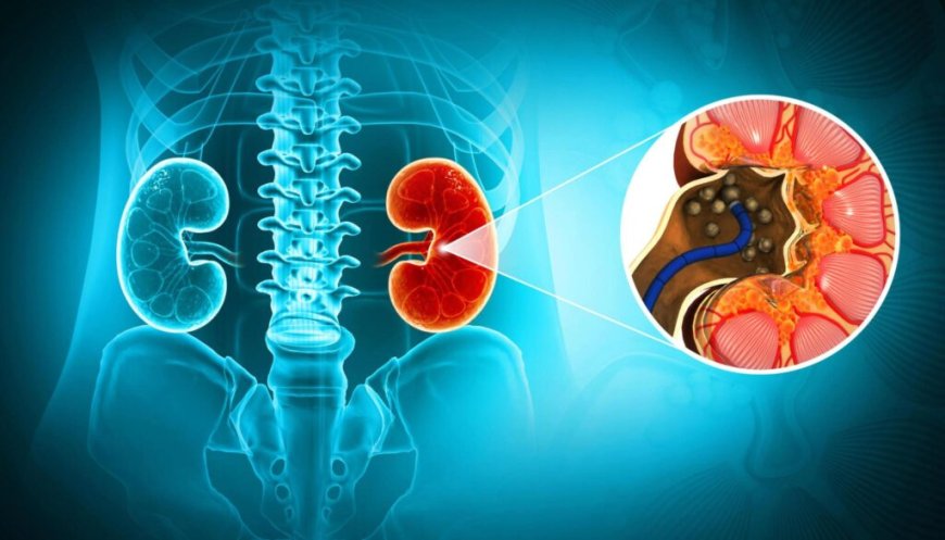 Looking for Kidney Stone Treatment in Jaipur? Here’s Your Complete Guide