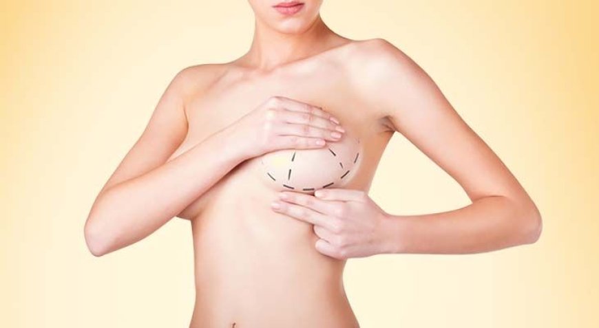 Best Breast Augmentation Surgeon in Dubai: How to Achieve the Perfect Proportions for Your Body