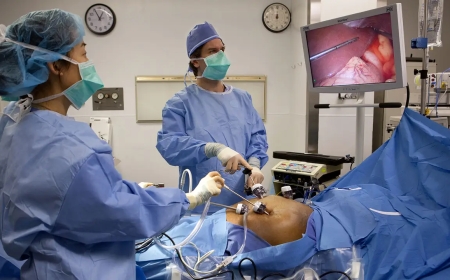 Bariatric Surgery Atlanta – Your Path to Lasting Weight Loss