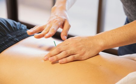 Top Micro Needling with Acupuncture Benefits for Skin, Health, and Wellness