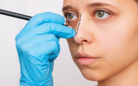 جراحة تجميل الأنف في الرياض لتحقيق مظهرك المثالي