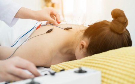 Richmond Hill Acupuncture Clinic – Restoring Balance, Naturally