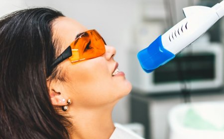 The Role of Diet and Lifestyle in Teeth Whitening Results