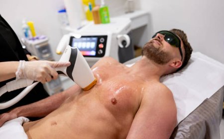 Laser Hair Removal Recovery Timeline: What Happens After Treatment?