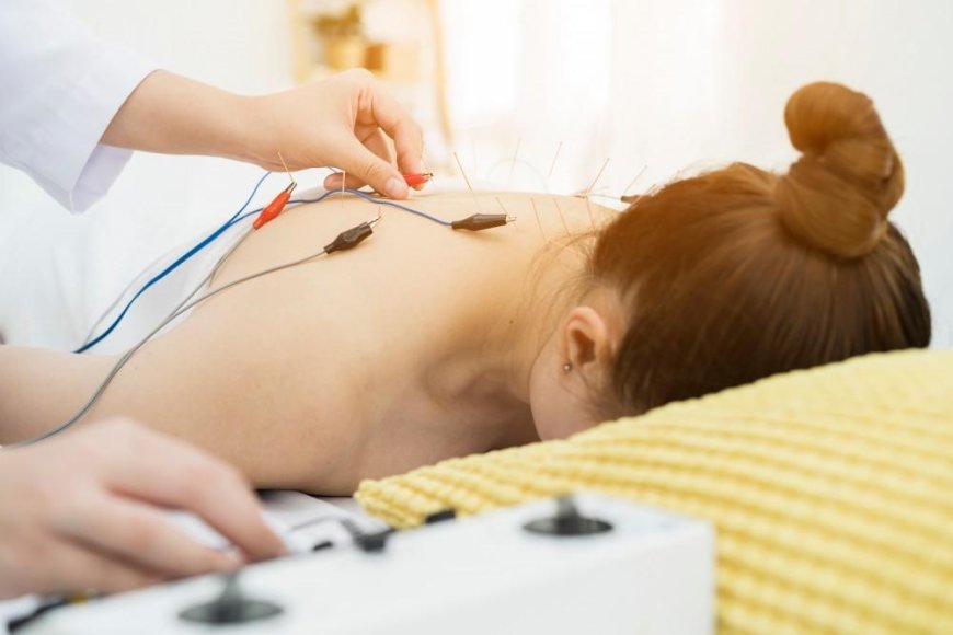 Richmond Hill Acupuncture Clinic – Restoring Balance, Naturally